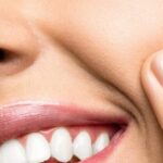 at home teeth whitening