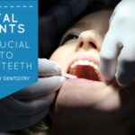 MFD May Blog - dental implants