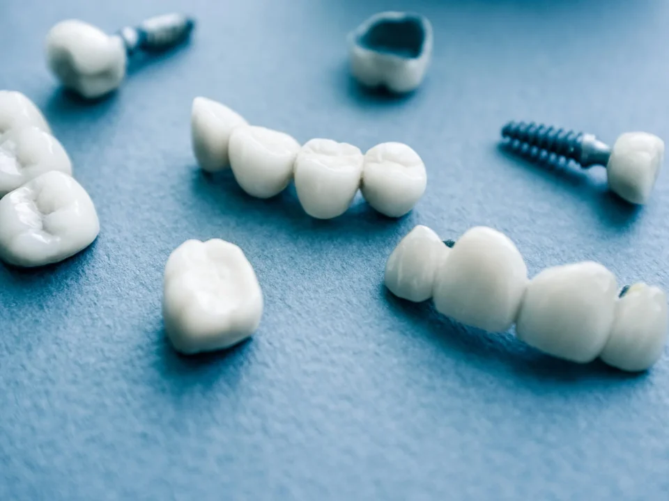 Surgical orthodontics, ceramic dental implants in Matthews, NC