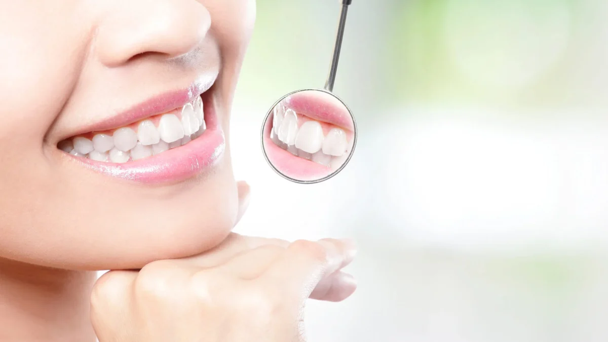 Healthy teeth of a female patient after visiting a cosmetic dentist in Matthews, NC