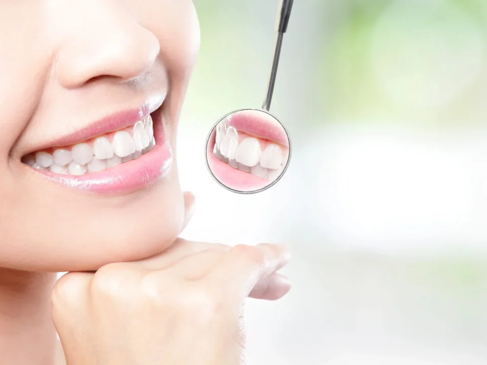 Healthy teeth of a female patient after visiting a cosmetic dentist in Matthews, NC