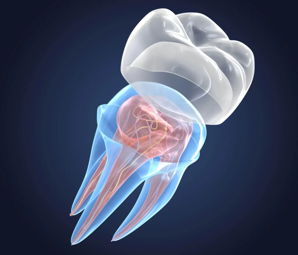 3D-rendering-of-transparent-teeth-showing-dental-crowns-in-Matthews-NC