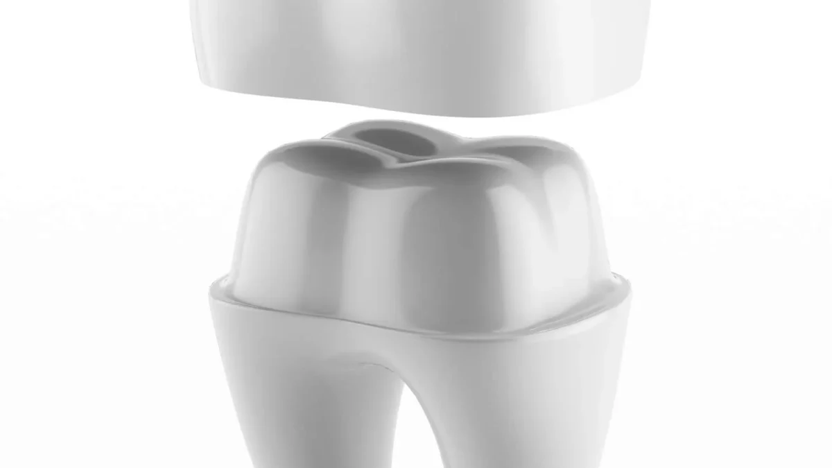 Dental-crowns-in-Matthews-NC.