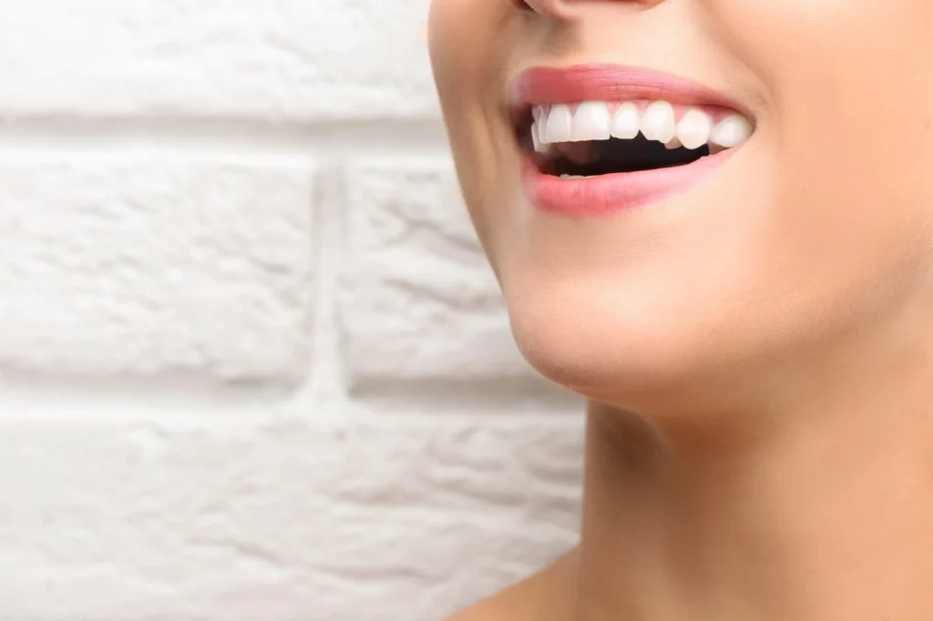 Woman-smiling-after-dental-crowns-in-Matthews-NC
