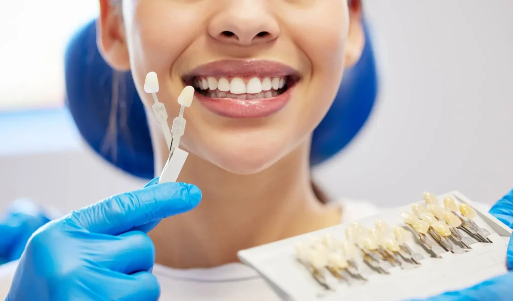 Dental-Procedure-Consultation-for-Veneers-Matthews-NC
