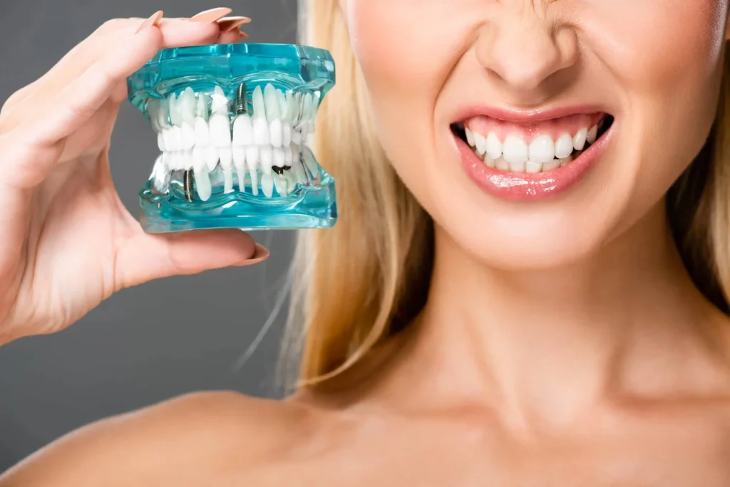 Woman-Showing-Smile-and-Jaw-Model-for-Veneers-Matthews-NC