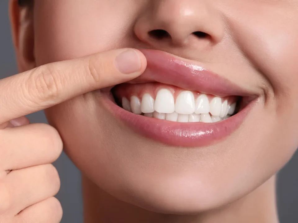Healthy Smile at Dentist Matthews NC
