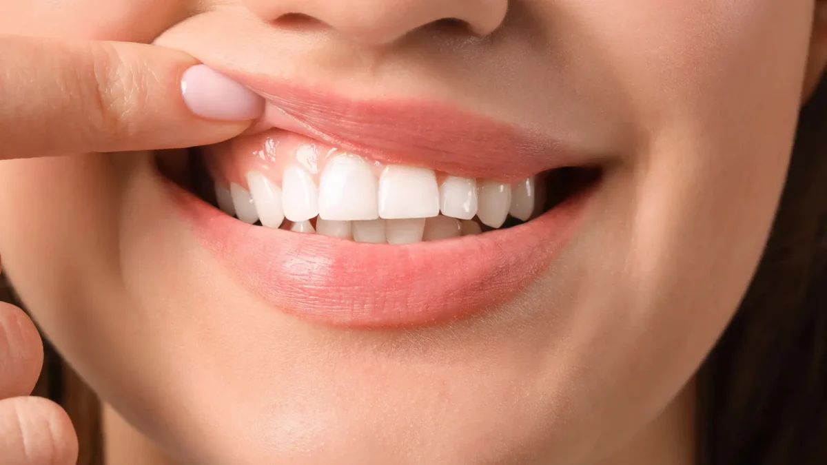 Healthy Gums at Dentist in Indian Trail, NC