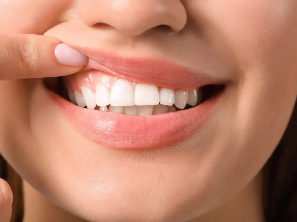 Healthy Gums at Dentist in Indian Trail, NC